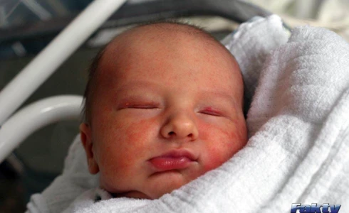 Korneliusz<br>Luranc