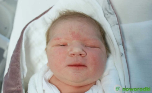 Anastazja<br>Niedośpiał