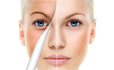 Wygraj zabiegi w Avenue Beauté