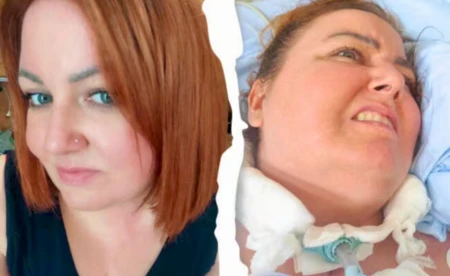 Monika z Brzeszcz walczy o życie. Wesprzyj leczenie i rehabilitację