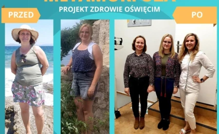 Mama i córka schudły łącznie 26 kg w Projekt Zdrowie Oświęcim