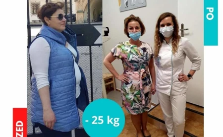 Kolejny sukces w Projekt Zdrowie Oświęcim - Kasia schudła 25 kg