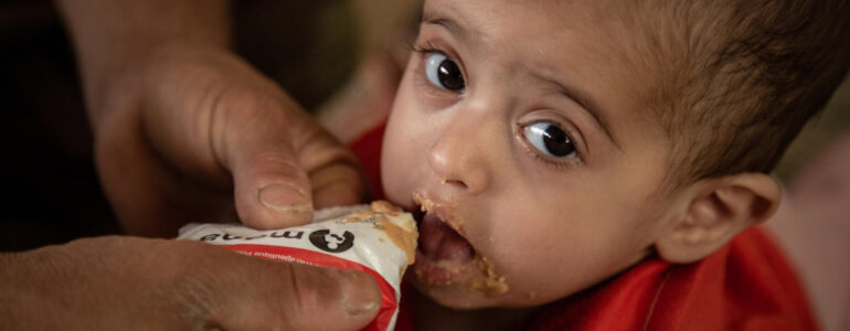 Świat przegrywa walkę z niedożywieniem – FILM, FOTO